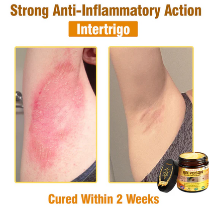 CREMA TODO EN UNO LOVILDS - VENENO DE ABEJA